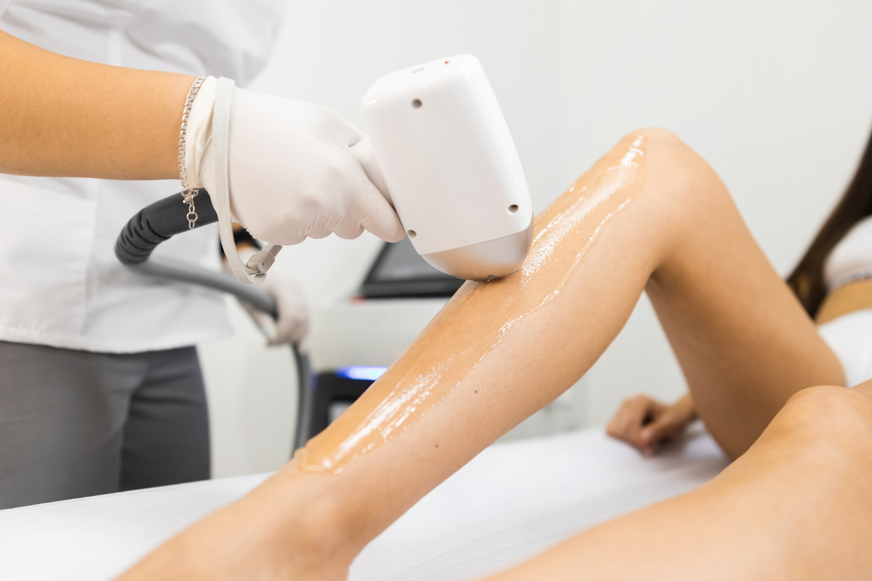 SHR Haarentfernung bei Beauty Concept in Weinheim