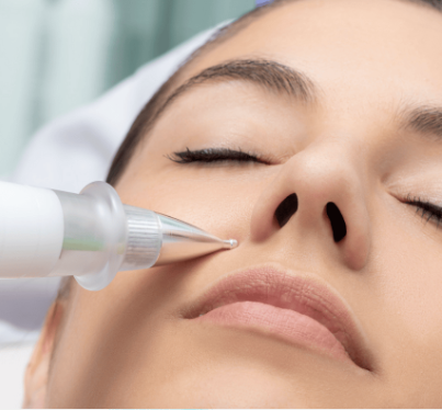 Plasma Pen bei Beauty Concept in Weinheim